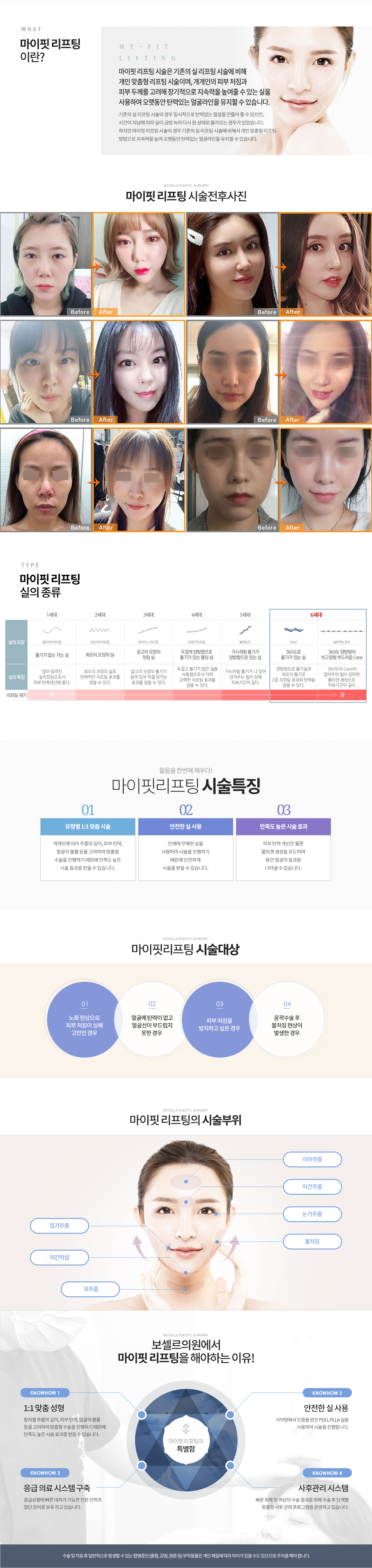 세븐업프리미엄리프팅컨텐츠